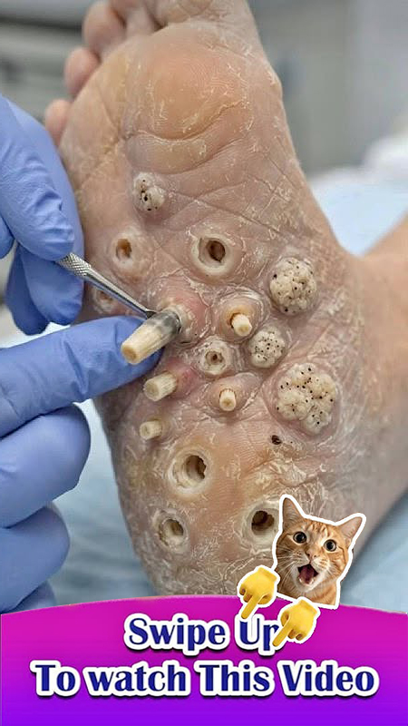 10 Signs Showing Something Is Wrong in Your Body